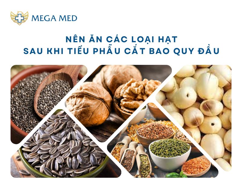 cắt bao quy đầu xong cần kiêng gì